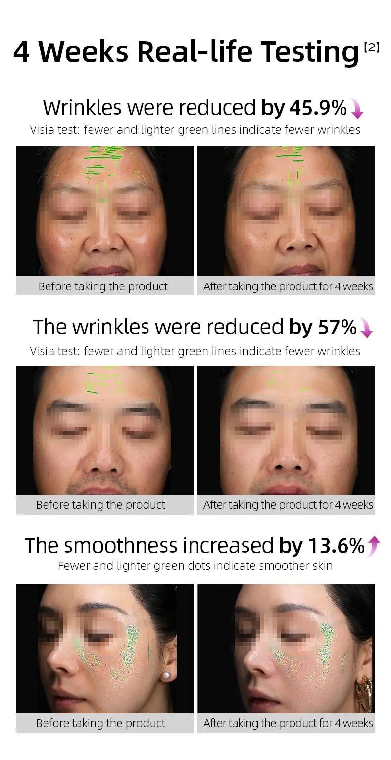 Before and after images showing the reduction of wrinkles and improvement in skin smoothness after 4 weeks of using Vida Glow Collagen Liquid.