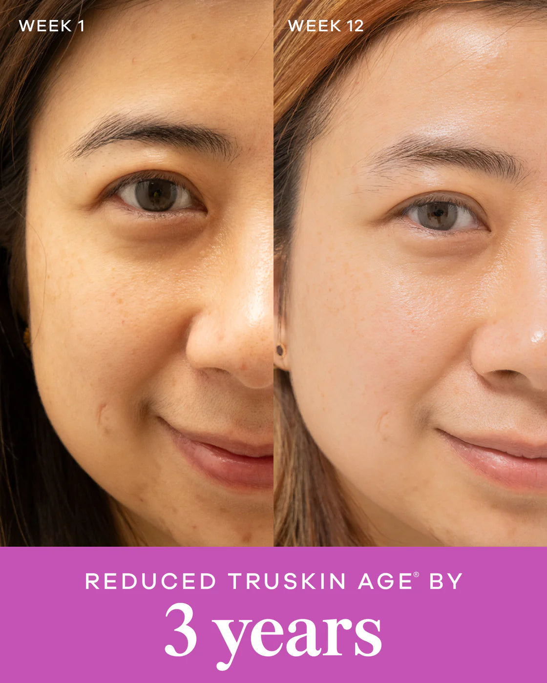 Before and after comparison of skin improvement over 12 weeks using Vida Glow Collagen Liquid, showing reduced TruSkin age by 3 years.