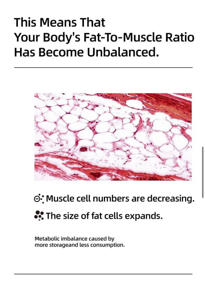 SRW Msc¹ Muscular System Tone