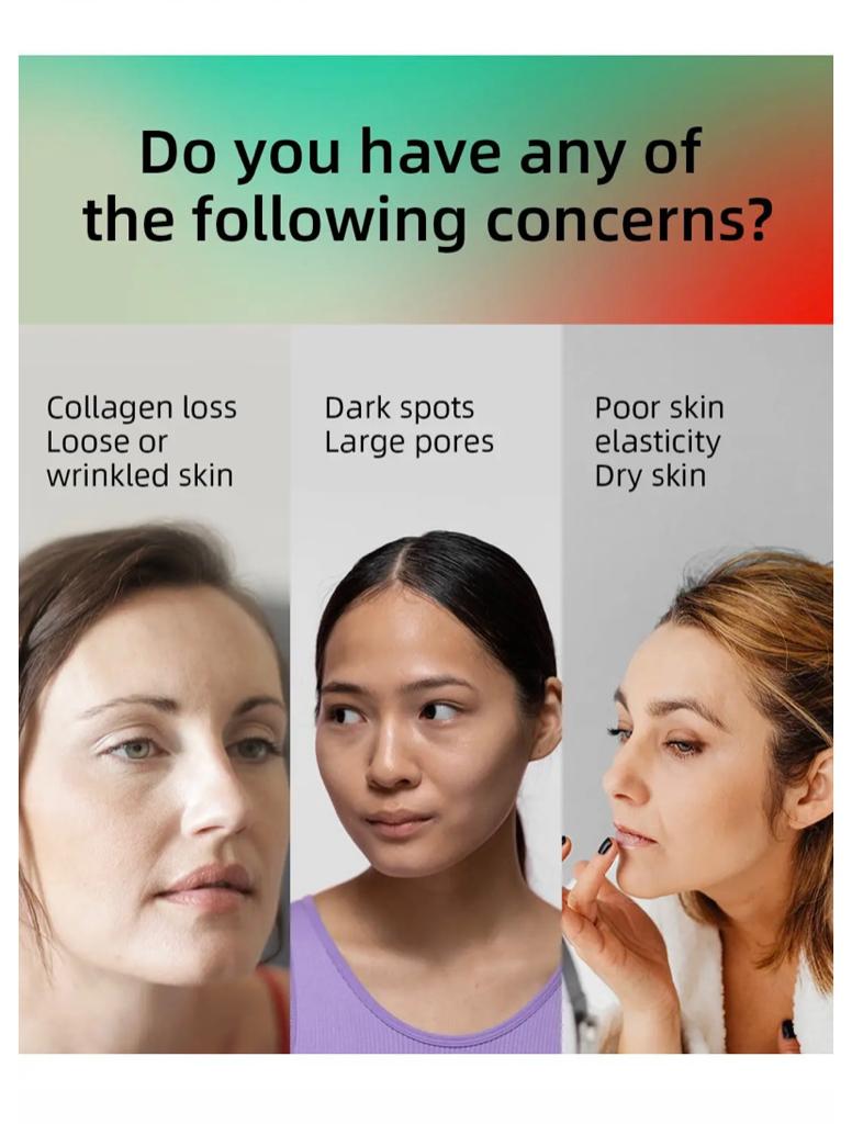 Do you have concerns like collagen loss, dark spots, large pores, poor skin elasticity, or dry skin? Vida Glow Collagen is suitable for addressing these issues.