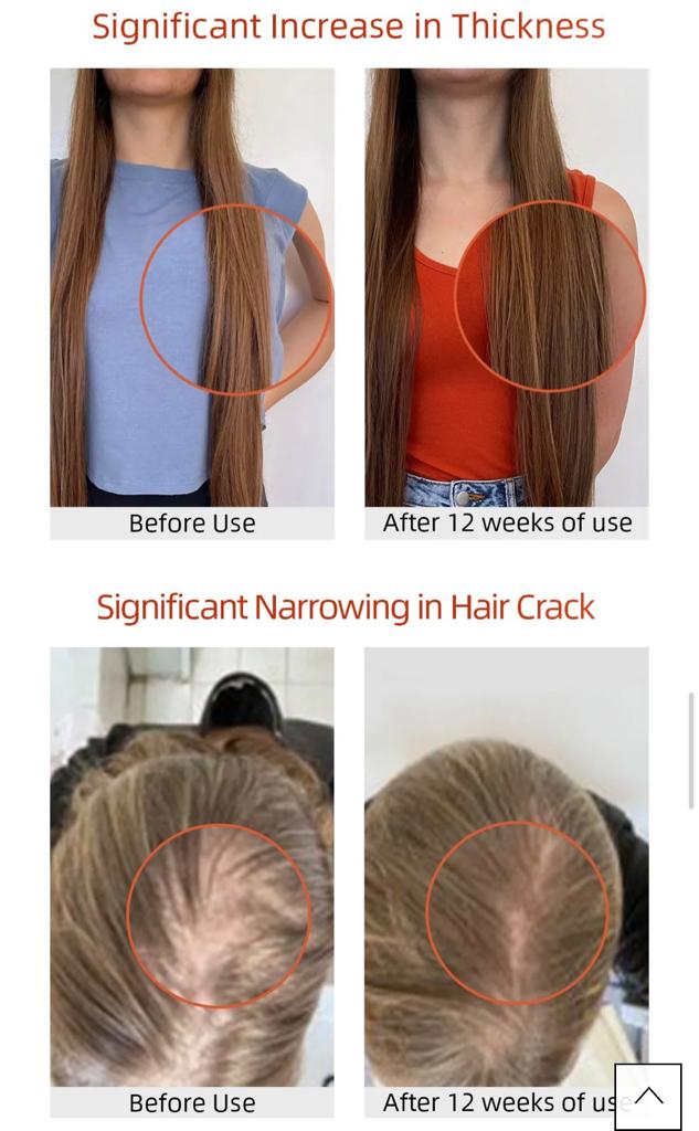 Before and after results showing significant increase in hair thickness and narrowing of hair cracks after 12 weeks of using Vida Glow Hairology Advanced Repair.