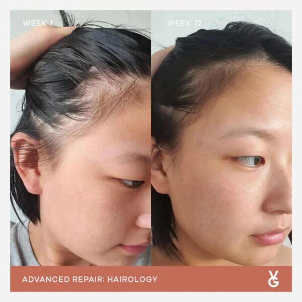 vida-glow-hairology-advanced-repair Vida Glow Hairology Advanced Repair | 30 Capsules